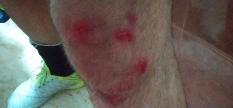 Compromís denuncia que el mal estat del parquet del poliesportiu Sebastián Mora causa danys als esportistes